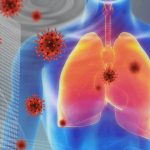 bệnh viêm phổi ở Vũ Hán